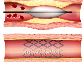 Medical_Industry